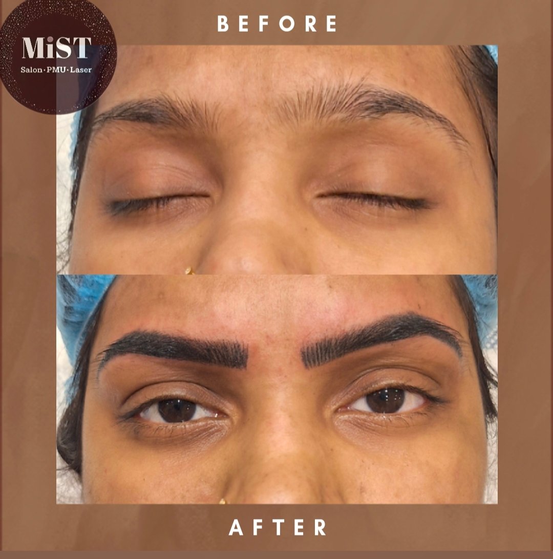 Eyebrow PMU before and after at MiST Unisex Salon, Kurnool
