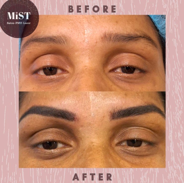 Eyebrow PMU before and after at MiST Unisex Salon, Kurnool