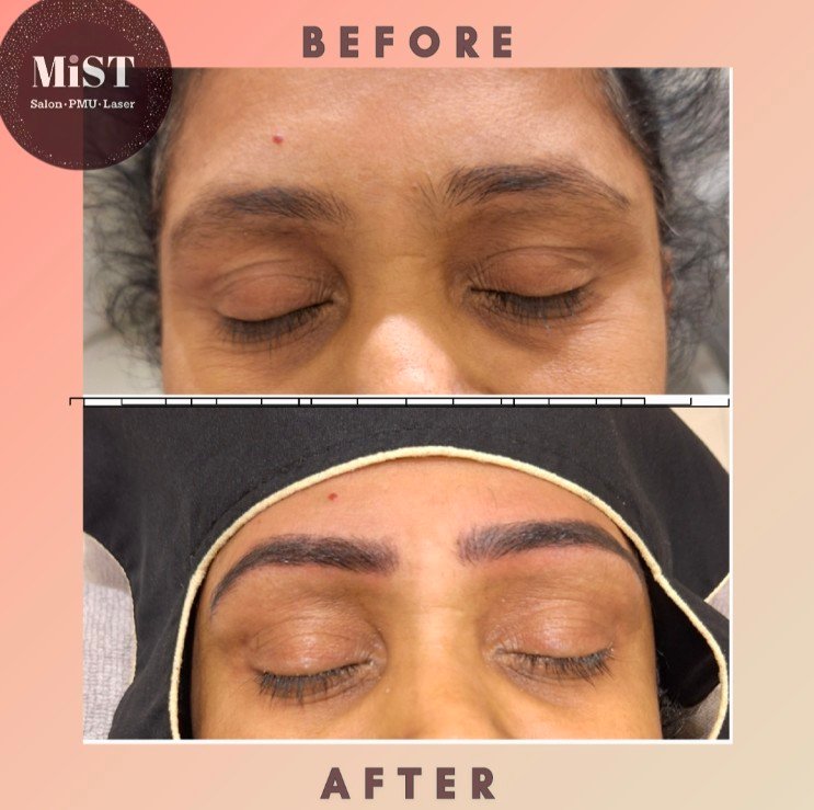Eyebrow PMU before and after at MiST Unisex Salon, Kurnool