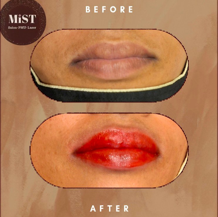 Lip blush before and after at MiST Unisex Salon, Kurnool