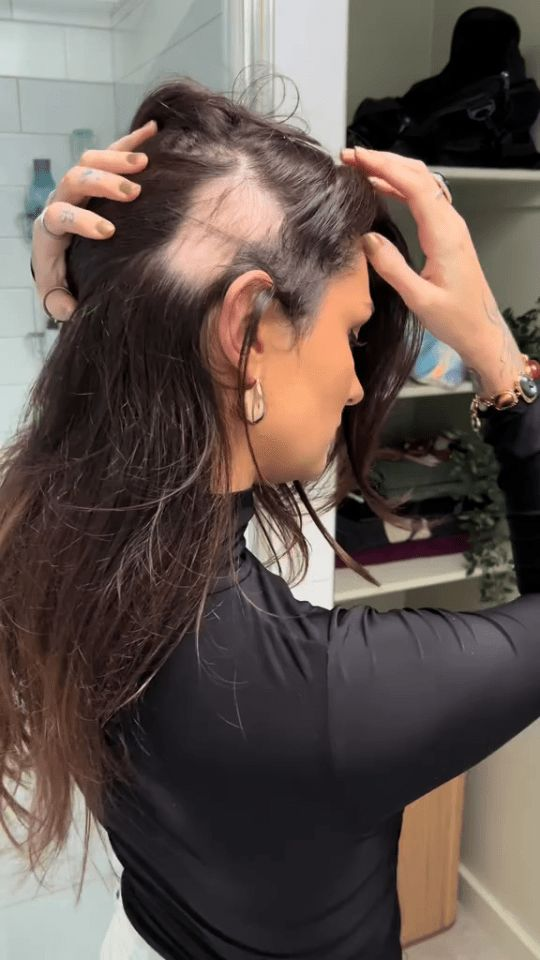 Hair Patches at MiST Unisex Salon, Kurnool