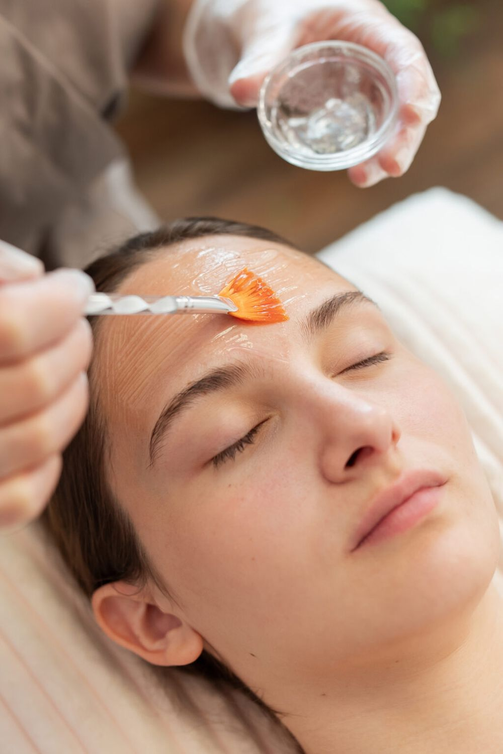 Chemical Peels at MiST Unisex Salon, Kurnool